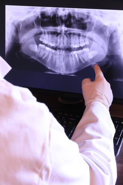 Best Cracked Tooth Emergency Dentist  in Robins Af, GA