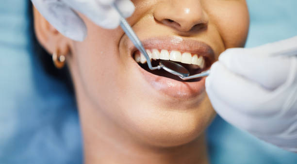 Best Emergency Dentist No Insurance  in Robins Af, GA