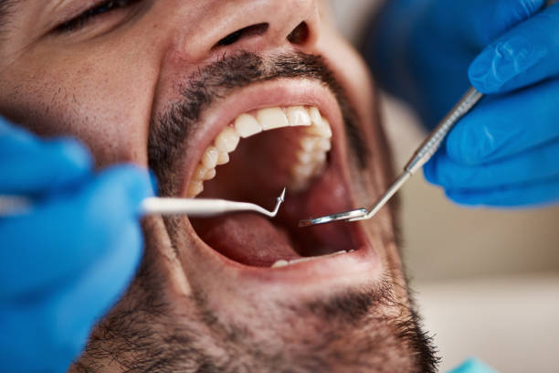 Best Urgent Dental Care  in Robins Af, GA